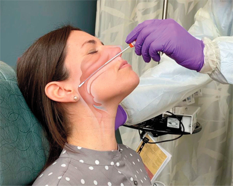 graphic of nasal swab